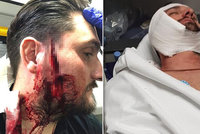 Při rvačce mladíka švihli páskem přes obličej. Řemen mu skoro uřízl tvář!