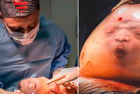Unikátní snímky z neuvěřitelného porodu: Chlapeček se narodil "v bublině" z plodového obalu