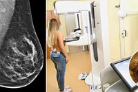Unikátní mamograf odhalí rakovinu prsu spolehlivěji! Lékařka: Je to i méně bolestivé!