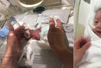 Nejmenší chlapec na světě vážil 268 gramů: V nemocnici bojoval o život pět měsíců