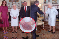 Starost o zdraví královny (92): Obří modřina na ruce! Královský palác mlčí!