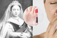 Nemoc, při níž hrozí vykrvácení: Jsou hemofilici potomky královny Viktorie? Odborníci řekli, jak to je!