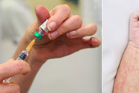 Nakažených spalničkami stále přibývá: 6 největších mýtů o nemoci a očkování