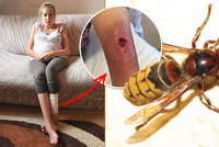 Těhotnou alergičku bodla vosa: Veroniku odmítal lékař ošetřit, v noze má teď díru!
