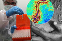 Laboratoří s viry eboly a pravých neštovic otřásl výbuch. „Nehrozí žádné nebezpečí,“ tvrdí Rusové