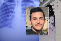 Tonda (19) kouřil dva roky e-cigaretu, plícemi starého kuřáka šokoval i lékaře