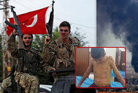 Děsivě popálené děti křičí o pomoc. Turci použili chemické zbraně, tvrdí Kurdové