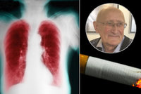 Zdeněk kouřil 40 cigaret denně, dostal zákeřnou chorobu plic. Až třetina Čechů jí trpí