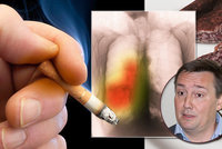 Kouříte a jíte uzeniny? Téměř 100% jistota plicní nemoci, varuje lékař