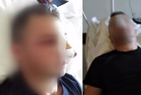 Brutální útok na hasiče Adriána: Mladík (17) mu o Silvestra rozmlátil obličej!