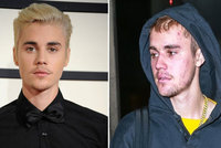 Šokující zpověď zpěváka Biebera: Nefetuju, jsem jen nemocný...