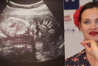 Kristýna Leichtová čeká druhé dítě! Rovnou se pochlubila snímkem z ultrazvuku