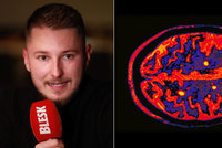 Homosexuál Tomáš (27) trpí roztroušenou sklerózou. Lékaři mu tvrdili, že má HIV