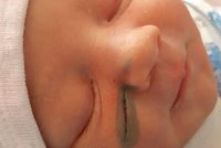 Hororový porod: Lékaři při císaři řízli dítě do tváře! Moc se mrskala, řekli matce