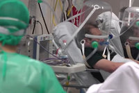 Šokující snímky z nemocnice: Pacientům s koronavirem nasazují podivné přilby!