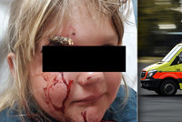 Hororový konec učení na kole: Dívce z Kladenska projel hlavou klacek po nárazu do stromu