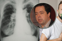 Odborníci upozorňují na záludnou plicní hypertenzi: Včasná diagnóza zachrání životy