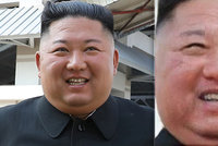 Je to Kim, nebo ne? KLDR ukázala dvojníka, tvrdí exposlankyně. Zuby jako důkaz