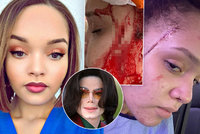 7 ran nožem! Brutálně napadli neteř Michaela Jacksona Yasmine (25)