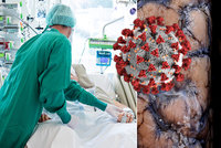 Experti řekli, jak koronavirus může poškodit mozek: Mrtvice, delirium i „pocuchané“ nervy