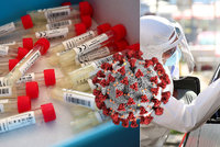 Na český trh zamíří test na koronavirus a chřipku zároveň. Vyvíjí ho Karlova univerzita