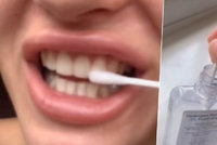 Nebezpečný trend z TikToku: Bělení zubů peroxidem vodíku! Zubaři jsou zděšeni