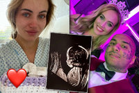 To láme srdce! Misska Kočendová po potratu sdílí ultrazvuk nenarozeného syna