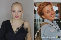 Anička Slováčková hodlá dát rakovině sbohem: Plánuje návrat k původnímu účesu!