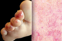 Nádory, žloutenka, covid i AIDS: Tyto nemoci prozradí naše kůže!