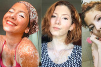 Modelku kvůli kožní nemoci šikanovali: „Ptali se mě, jaké to mám tam dole,“ říká