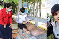 Infikovaný komár zničil mladému muži život: Pár štípanců a noha mu narostla do obřích rozměrů!
