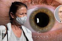 Roušky způsobují vysušení očí, zjistili lékaři. A i přes oči se můžete nakazit koronavirem