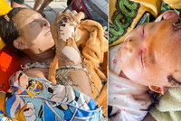 Ženu i její miminko málem zabil výbuch plynu: Explozi způsobila vonná tyčinka!