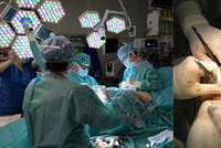 Lékaři IKEMu i navzdory koronaviru pracovali na plné obrátky. Loni transplantovali skoro 500 orgánů!