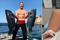 Žralokovi dal pěstí a plaval jak o život: Pokousaný rybář doplatil na souboj o úlovek