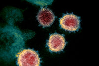 Jak zabránit další pandemii? Na světě je 1,7 milionu neznámých virů, varuje OSN