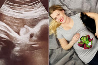 Těhotná muzikálová kráska konečně ukázala ultrazvuk: Takhle vypadá její princezna!