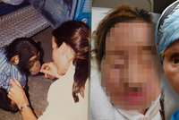 Milovaný šimpanz Travis v záchvatu brutálně napadl ženu: Roztrhal jí obličej a snědl oči