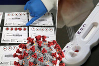 Testy na protilátky: Můžete se s nimi prokazovat? Ve spoustě případů narazíte