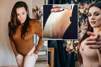 Odvážná Ewa Farna ukázala tělo po porodu: Strie na břiše a výkyvy na váze!